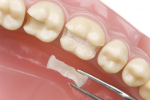 Ästhetische Zahnheilkunde 2
